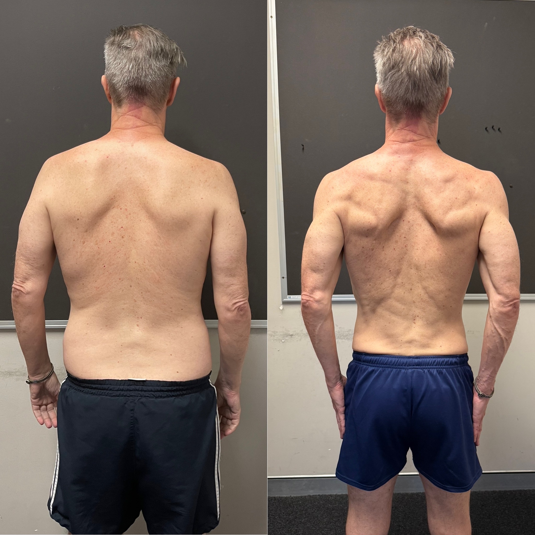 Duncan back before and after