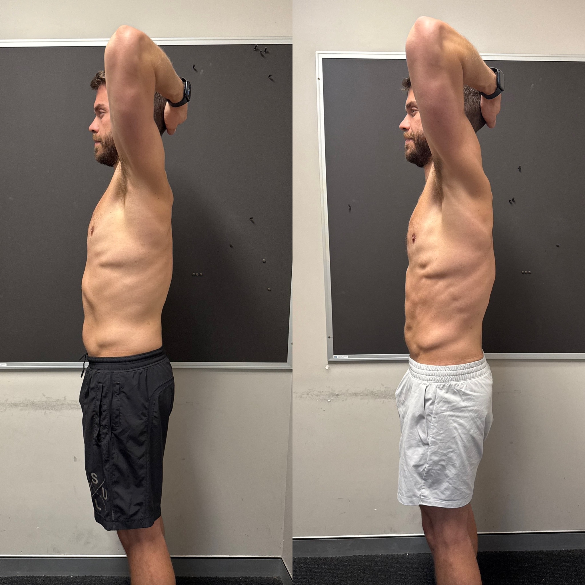 James side before and after