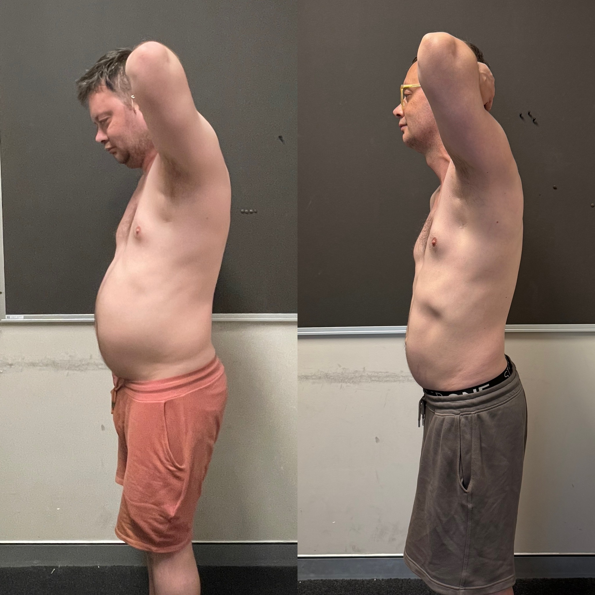 Tim side before and after